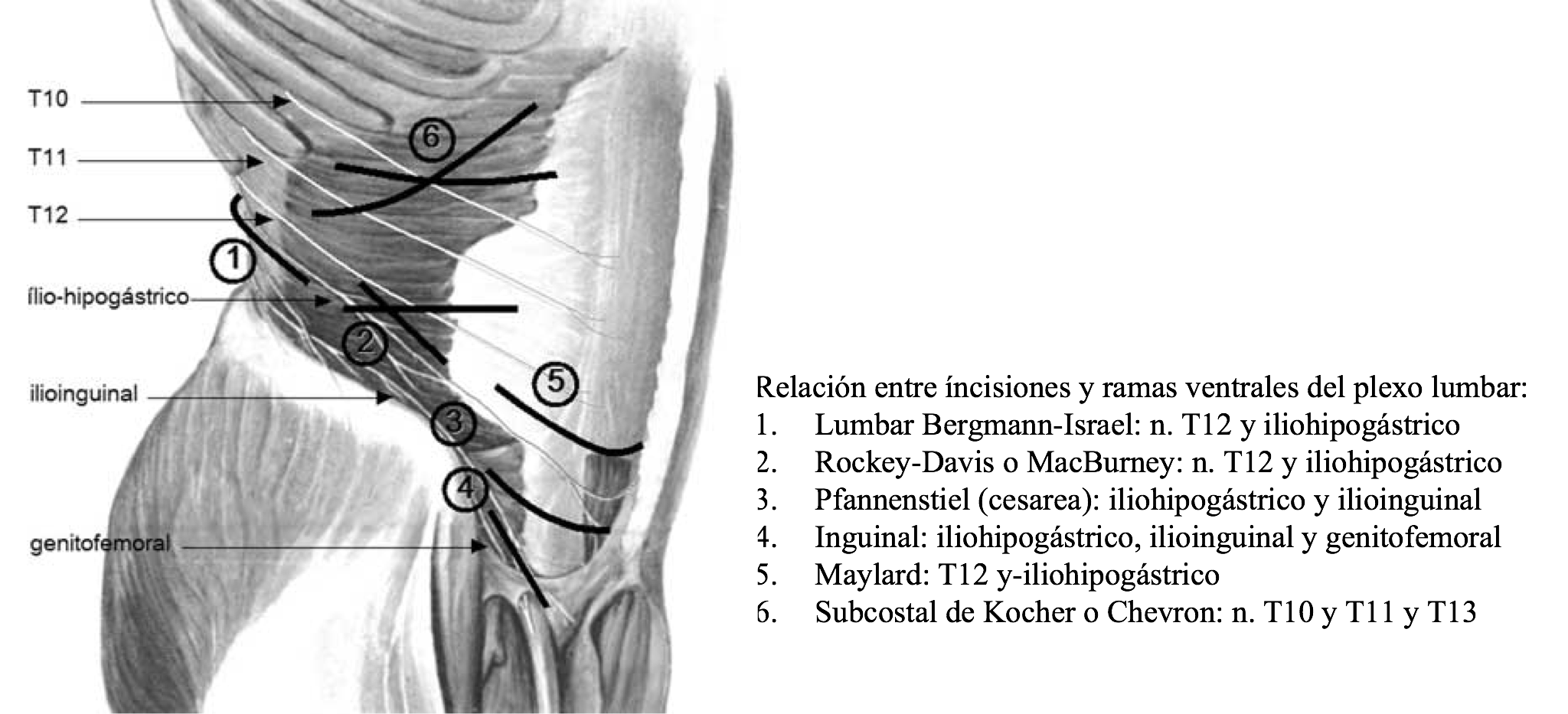 Cirugia De La Hernia Inguinal Doctor Alvaro Bueno