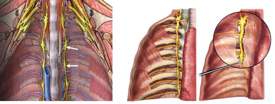 Hiperhidrosis-5